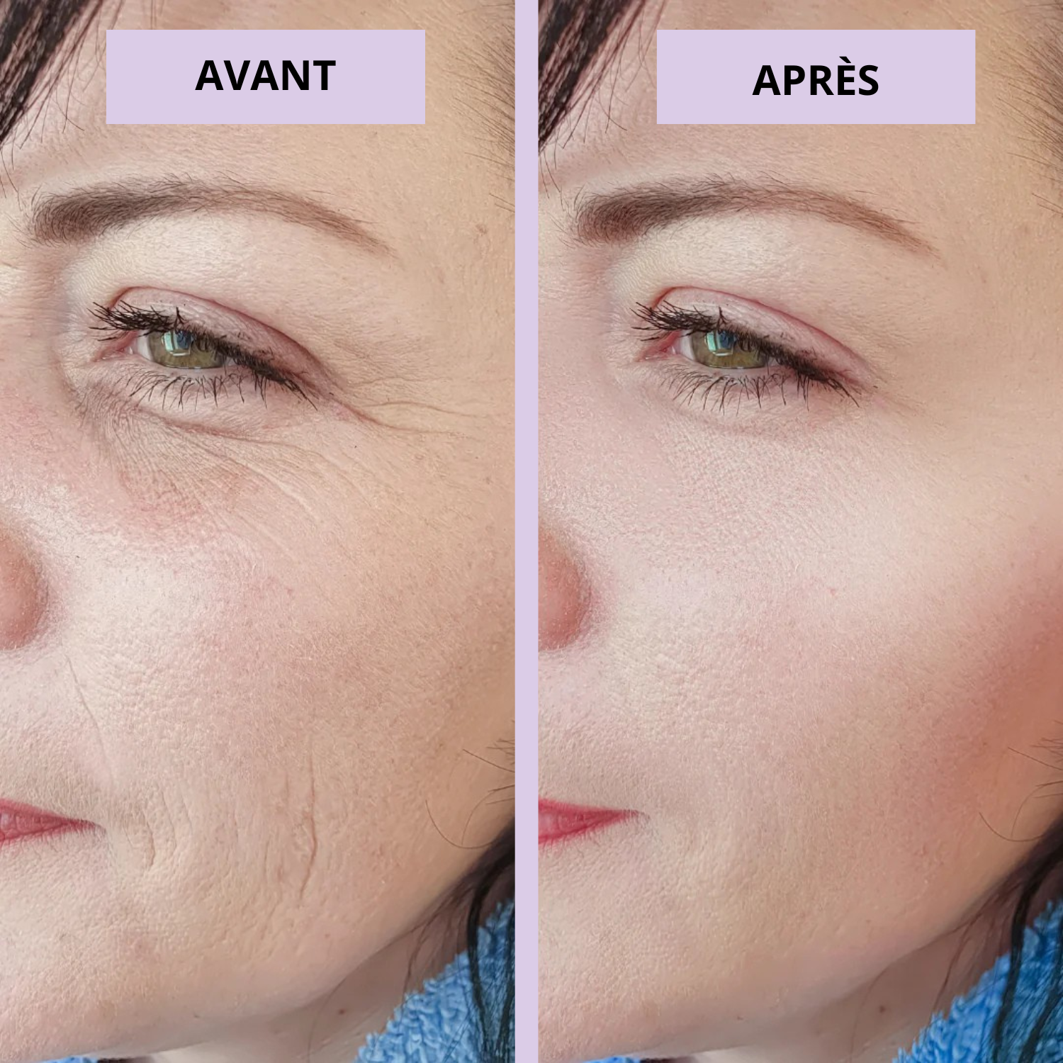 BotoxStick™ | Anti-rides au Calcium et Collagène